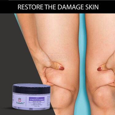 Anti Stretch Mark Cream