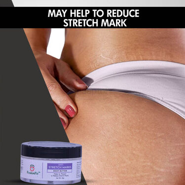 Anti Stretch Mark Cream