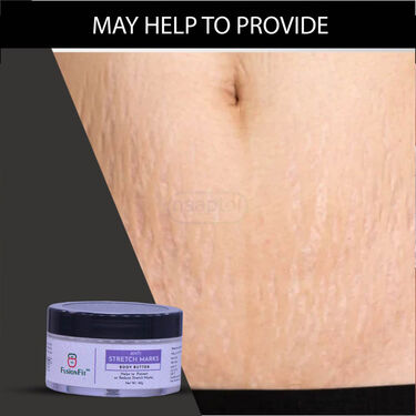 Anti Stretch Mark Cream