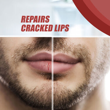 Lip Brightening & Repair Combo For Men (LBRCM)