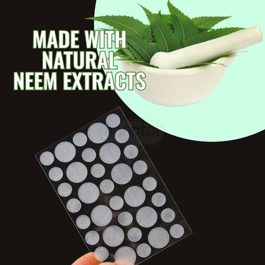 Neem Acne Patches - Pack of 2 (72 Patches)