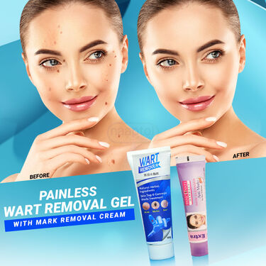 Painless Wart Removal Gel With Mark Removal Cream