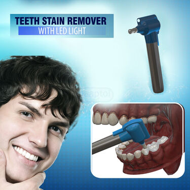 Teeth Whitener Stain Remover With LED Light (TW1)